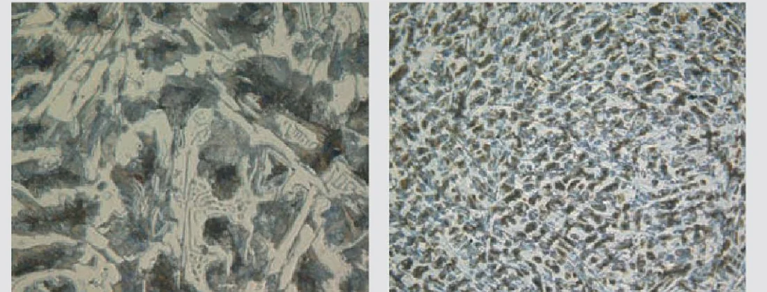 Microstructure of TUPY Brazil blackheart malleable cast iron at 100x and 500x magnification